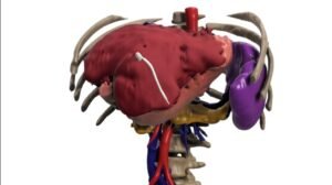 Cirugia 3D